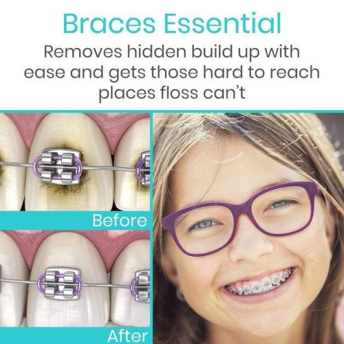 6 braces essential f7c55f53 c84c 4b13 b7ab f55fadac06e5