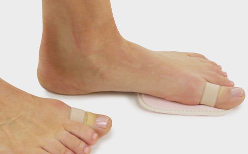 Feet wearing toe splint